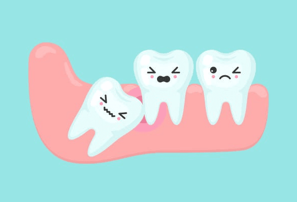 wisdom tooth extraction cost