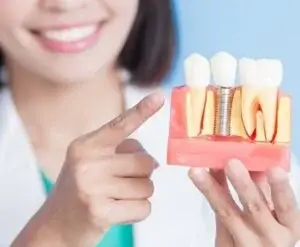 Dental Implants